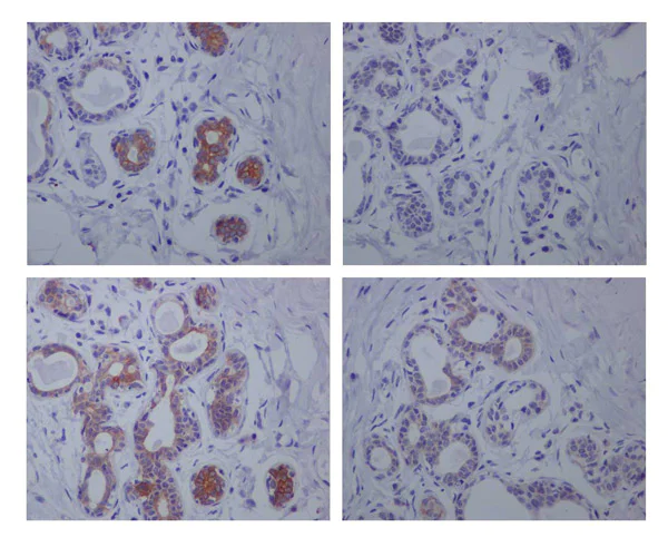Immunohistochemistry (Formalin/PFA-fixed paraffin-embedded sections) - Anti-GSK3 beta (phospho S9) antibody [EPR2286Y] (AB75814)