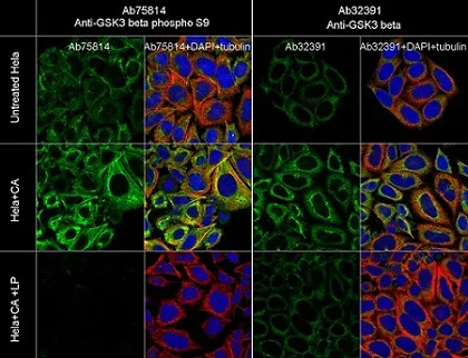 Immunocytochemistry/ Immunofluorescence - Anti-GSK3 beta (phospho S9) antibody [EPR2286Y] - BSA and Azide free (AB219359)