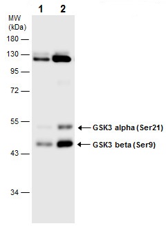 Western blot - Anti-GSK3 beta (phospho S9) + GSK3 alpha (phospho S21) antibody (AB226877), expandable thumbnail