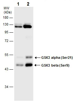 Western blot - Anti-GSK3 beta (phospho S9) + GSK3 alpha (phospho S21) antibody (AB226877)