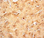 Immunohistochemistry (Formalin/PFA-fixed paraffin-embedded sections) - Anti-GSK3 beta (phospho Y216) + GSK3 alpha (phospho Y279) antibody [EPR933Y] - BSA and Azide free (AB239862)