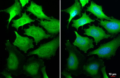 Immunocytochemistry/ Immunofluorescence - Anti-GSPT1 antibody [HL1346] (AB307498)