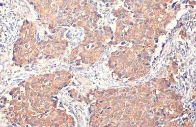 Immunohistochemistry (Formalin/PFA-fixed paraffin-embedded sections) - Anti-GSPT1 antibody [HL1346] (AB307498)