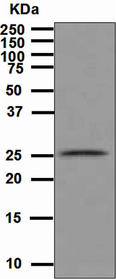 Western blot - Anti-GST antibody [EPR4236] (AB111947), expandable thumbnail