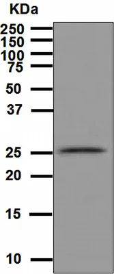 Western blot - Anti-GST antibody [EPR4236] (AB111947)