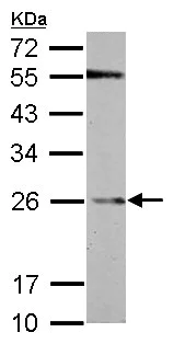 Western blot - Anti-GST3 / GST pi antibody (AB153949)