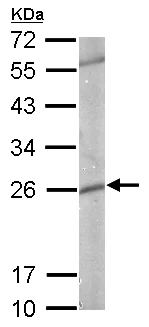Western blot - Anti-GST3 / GST pi antibody (AB153949)
