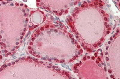 Immunohistochemistry (Formalin/PFA-fixed paraffin-embedded sections) - Anti-GST3 / GST pi antibody (AB233112)