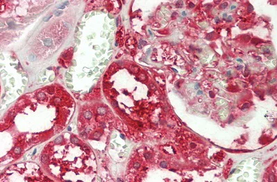 Immunohistochemistry (Formalin/PFA-fixed paraffin-embedded sections) - Anti-GST3 / GST pi antibody (AB233112)