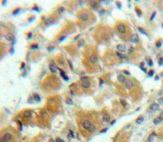 Immunohistochemistry (Formalin/PFA-fixed paraffin-embedded sections) - Anti-GST3 / GST pi antibody (AB233112)