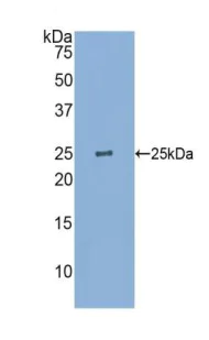 Western blot - Anti-GST3 / GST pi antibody (AB233112)