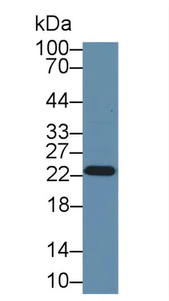 Western blot - Anti-GST3 / GST pi antibody (AB233112)