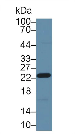 Western blot - Anti-GST3 / GST pi antibody (AB233112)