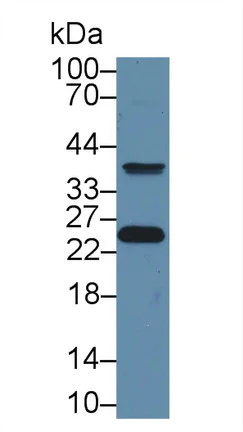 Western blot - Anti-GST3 / GST pi antibody (AB233112)