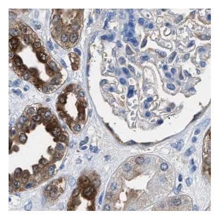 Immunohistochemistry (Formalin/PFA-fixed paraffin-embedded sections) - Anti-GST3 / GST pi antibody (AB259373), expandable thumbnail