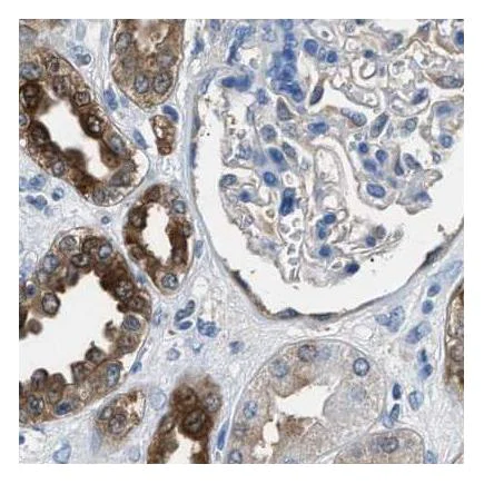 Immunohistochemistry (Formalin/PFA-fixed paraffin-embedded sections) - Anti-GST3 / GST pi antibody (AB259373)