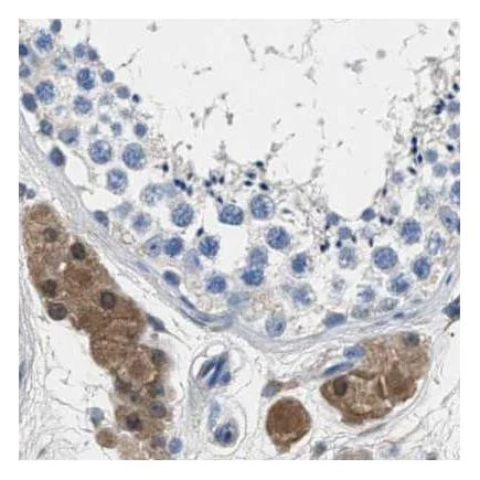 Immunohistochemistry (Formalin/PFA-fixed paraffin-embedded sections) - Anti-GST3 / GST pi antibody (AB259373)