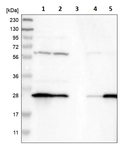Western blot - Anti-GST3 / GST pi antibody (AB259373)