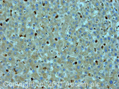 Immunohistochemistry (Formalin/PFA-fixed paraffin-embedded sections) - Anti-GST3 / GST pi antibody (AB53943)