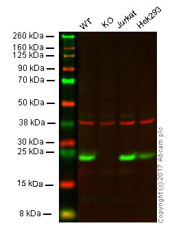 Western blot - Anti-GST3 / GST pi antibody [EPR8262] (AB134934)