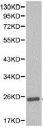 Western blot - Anti-GSTA1 antibody (AB180650)