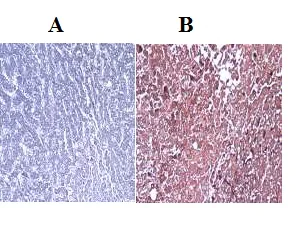 Immunohistochemistry (Formalin/PFA-fixed paraffin-embedded sections) - Anti-GSTA1 antibody (AB53940)