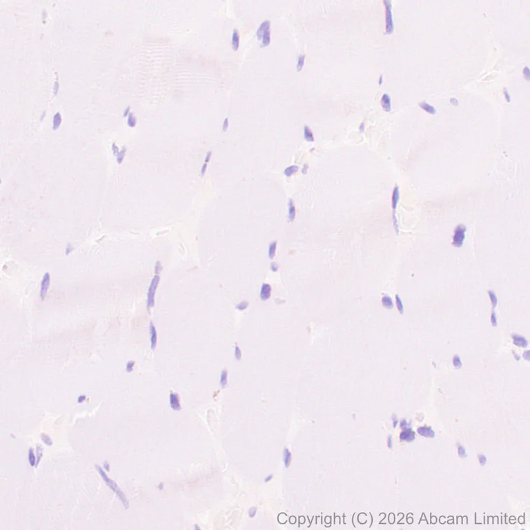 Immunohistochemistry (Formalin/PFA-fixed paraffin-embedded sections) - Anti-GSTA1 antibody [EPR29819-588] (AB326944)