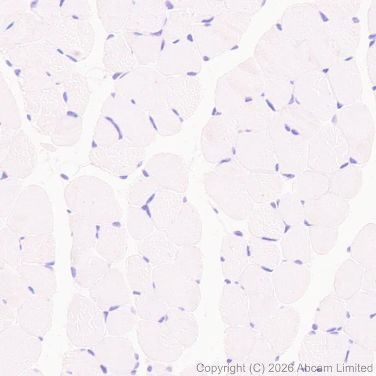 Immunohistochemistry (Formalin/PFA-fixed paraffin-embedded sections) - Anti-GSTA1 antibody [EPR29819-588] (AB326944)
