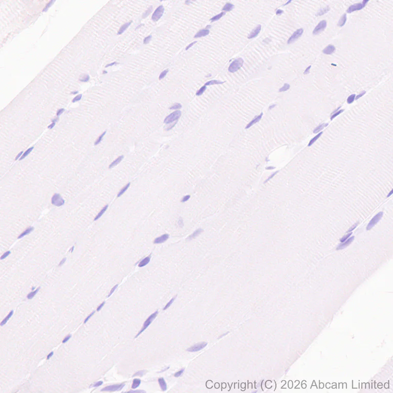 Immunohistochemistry (Formalin/PFA-fixed paraffin-embedded sections) - Anti-GSTA1 antibody [EPR29819-588] (AB326944)