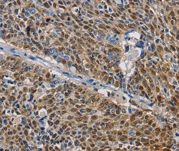 Immunohistochemistry (Formalin/PFA-fixed paraffin-embedded sections) - Anti-GSTA2 antibody (AB199115)