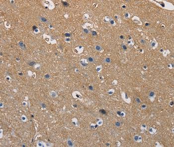 Immunohistochemistry (Formalin/PFA-fixed paraffin-embedded sections) - Anti-GSTA2 antibody (AB199115)