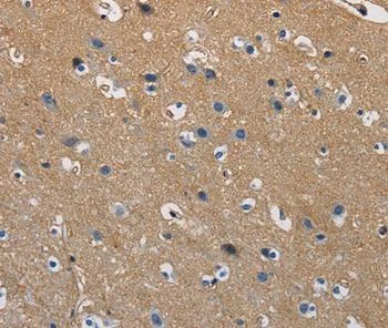 Immunohistochemistry (Formalin/PFA-fixed paraffin-embedded sections) - Anti-GSTA2 antibody (AB199115)