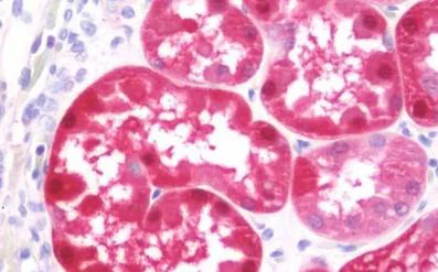Immunohistochemistry (Formalin/PFA-fixed paraffin-embedded sections) - Anti-GSTA2 antibody (AB211449)