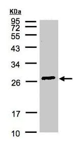 Western blot - Anti-GSTA2 antibody (AB211449)