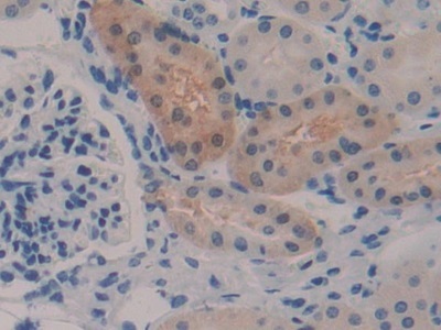 Immunohistochemistry (Formalin/PFA-fixed paraffin-embedded sections) - Anti-GSTA2 antibody (AB232833), expandable thumbnail