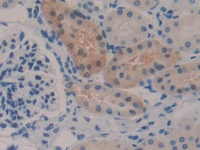Immunohistochemistry (Formalin/PFA-fixed paraffin-embedded sections) - Anti-GSTA2 antibody (AB232833)