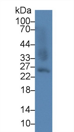 Western blot - Anti-GSTA2 antibody (AB232833), expandable thumbnail