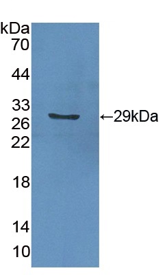 Western blot - Anti-GSTA2 antibody (AB232833), expandable thumbnail