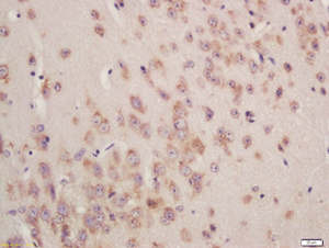 Immunohistochemistry (Formalin/PFA-fixed paraffin-embedded sections) - Anti-GSTA3 antibody (AB203311)