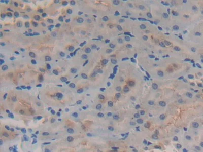 Immunohistochemistry (Formalin/PFA-fixed paraffin-embedded sections) - Anti-GSTA4 antibody (AB231601)