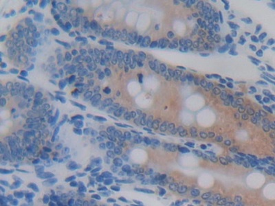 Immunohistochemistry (Formalin/PFA-fixed paraffin-embedded sections) - Anti-GSTA4 antibody (AB231601)