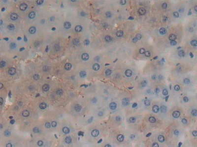 Immunohistochemistry (Formalin/PFA-fixed paraffin-embedded sections) - Anti-GSTA4 antibody (AB231601)