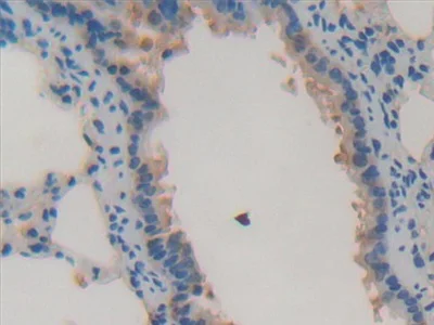 Immunohistochemistry (Formalin/PFA-fixed paraffin-embedded sections) - Anti-GSTA4 antibody (AB231601)