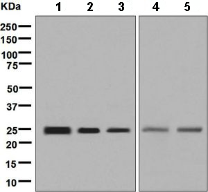 Western blot - Anti-GSTA4 antibody [EPR8404(B)] - BSA and Azide free (AB248729)
