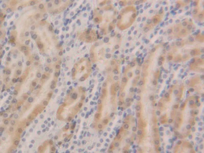 Immunohistochemistry (Formalin/PFA-fixed paraffin-embedded sections) - Anti-GSTA5 antibody (AB232871)