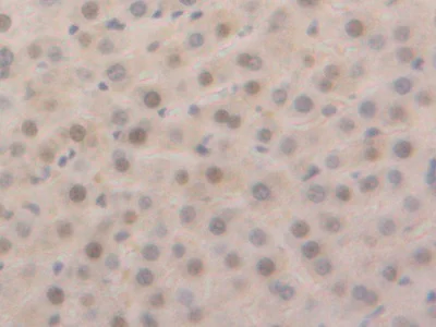 Immunohistochemistry (Formalin/PFA-fixed paraffin-embedded sections) - Anti-GSTA5 antibody (AB232871)