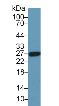 Western blot - Anti-GSTA5 antibody (AB232871)