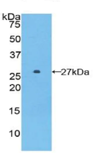 Western blot - Anti-GSTA5 antibody (AB232871)