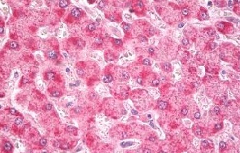 glutathione s-transferase kappa 1 Glutathione S-transferase kappa 1