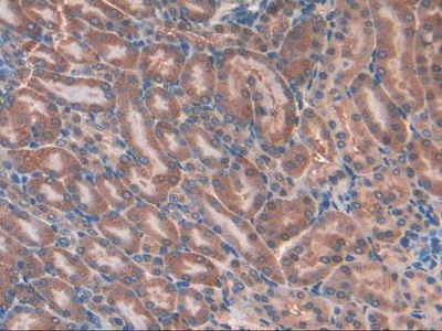 Immunohistochemistry (Formalin/PFA-fixed paraffin-embedded sections) - Anti-GSTK1 antibody (AB231549), expandable thumbnail